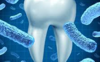 Bactéria da periodontite pode causar artrite reumatóide